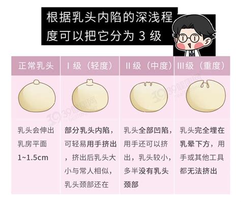 乳頭 長毛|乳頭內凹、長毛正常嗎？ 8類「乳頭形狀」你的是哪種 